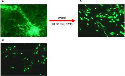 Neutrophil extracellular traps in upper respiratory tract secretions: insights into infectious and allergic rhinitis